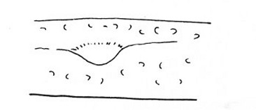 Fig. 
