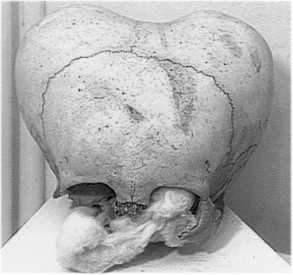 Crâne Alien?